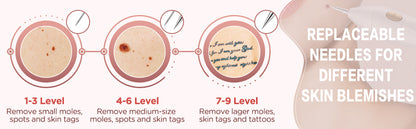 Fibroblast Skin Tag Remover Plasma Pen